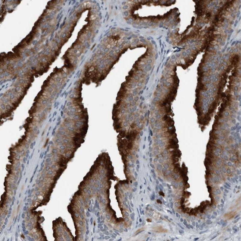 GAK Antibody - BSA Free Immunohistochemistry-Paraffin: GAK Antibody - BSA Free [NBP1-89441]