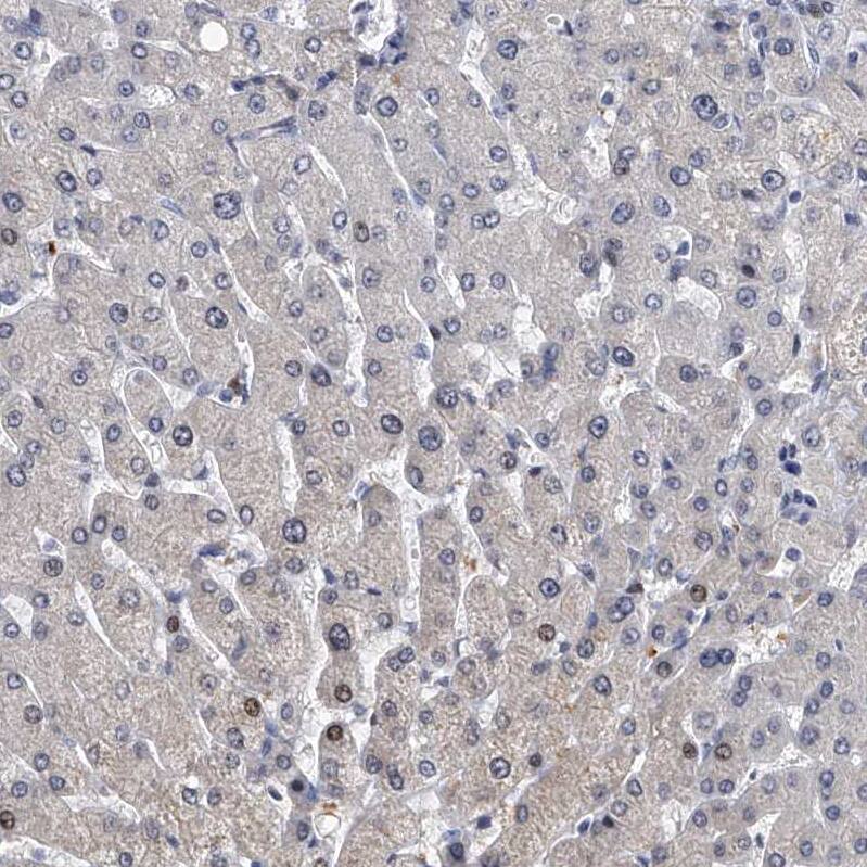TESK2 Antibody - BSA Free Immunohistochemistry-Paraffin: TESK2 Antibody - BSA Free [NBP1-89442]