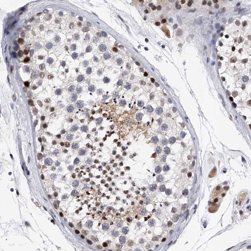 TESK2 Antibody - BSA Free Immunohistochemistry-Paraffin: TESK2 Antibody - BSA Free [NBP1-89442]