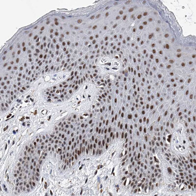 TESK2 Antibody - BSA Free Immunohistochemistry-Paraffin: TESK2 Antibody - BSA Free [NBP1-89442]