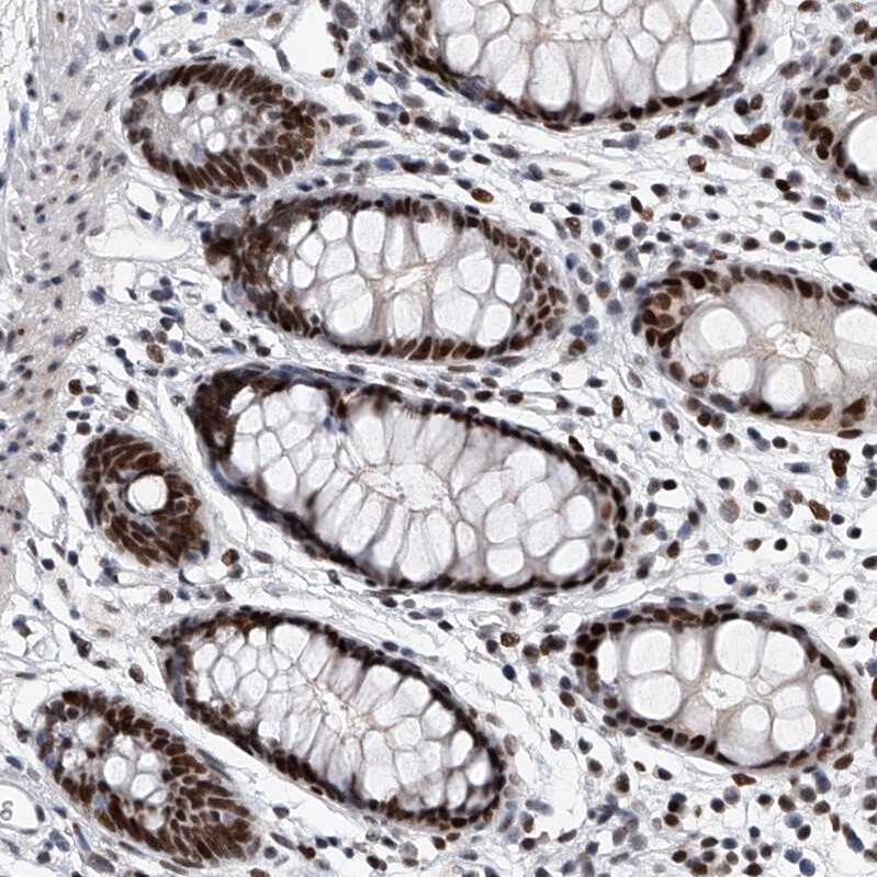 TESK2 Antibody - BSA Free Immunohistochemistry-Paraffin: TESK2 Antibody - BSA Free [NBP1-89442]
