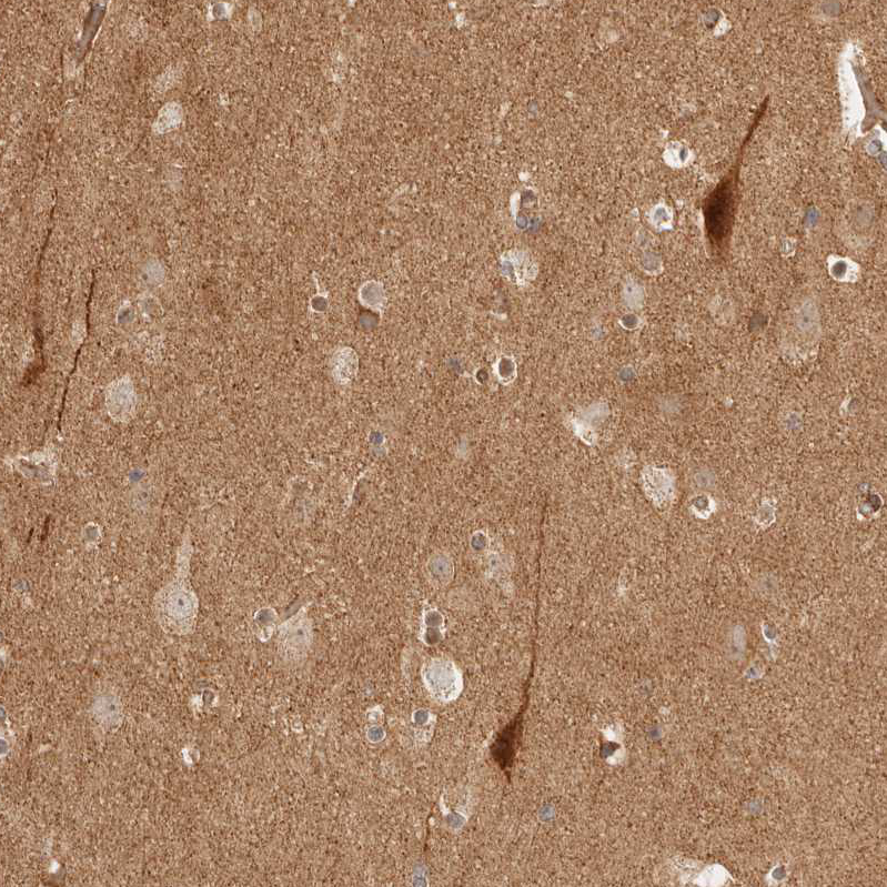 BAALC Antibody - BSA Free Immunohistochemistry-Paraffin: BAALC Antibody - BSA Free [NBP1-89443]