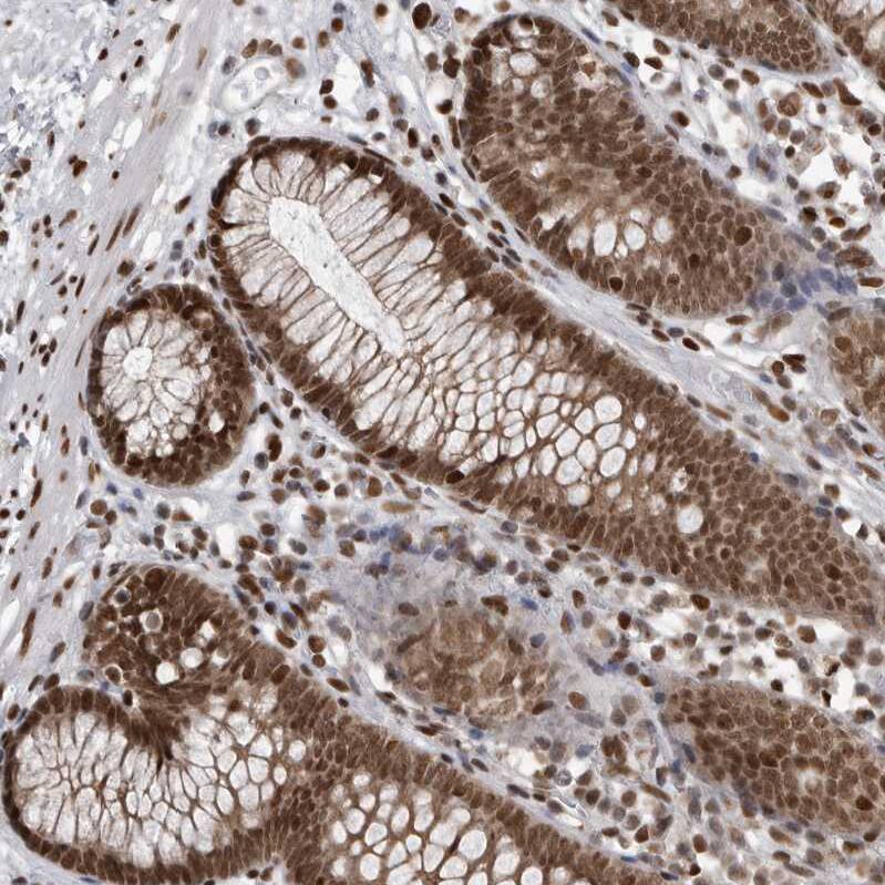 YAF2 Antibody - BSA Free Immunohistochemistry-Paraffin: YAF2 Antibody - BSA Free [NBP1-89444]