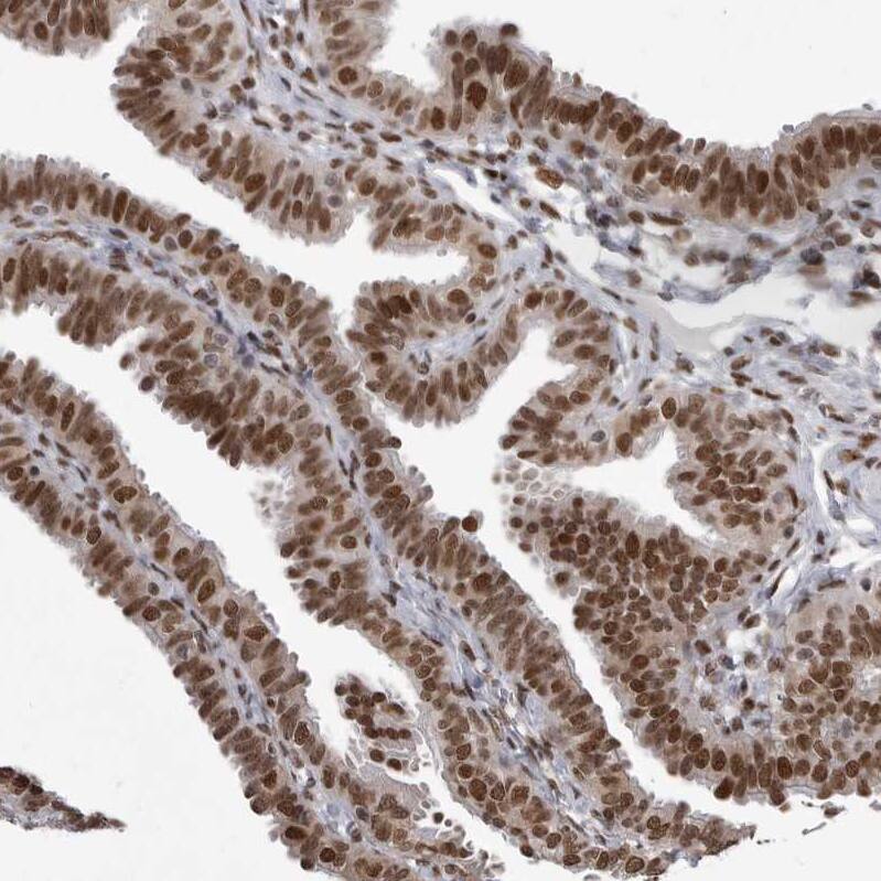 YAF2 Antibody - BSA Free Immunohistochemistry-Paraffin: YAF2 Antibody - BSA Free [NBP1-89444]