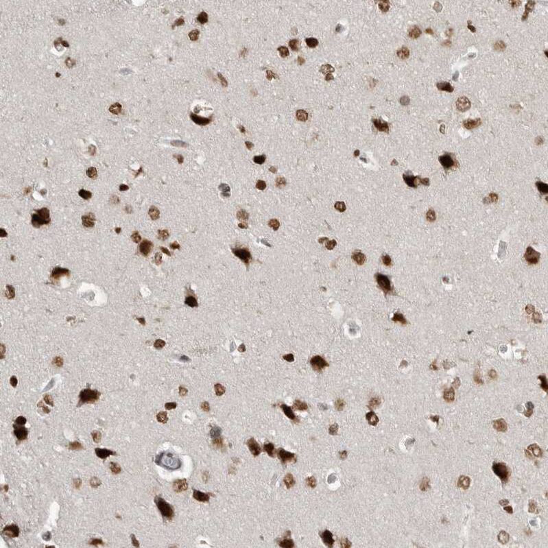 YAF2 Antibody - BSA Free Immunohistochemistry-Paraffin: YAF2 Antibody - BSA Free [NBP1-89444]