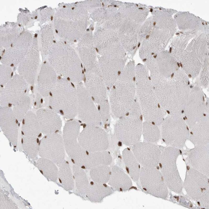 YAF2 Antibody - BSA Free Immunohistochemistry-Paraffin: YAF2 Antibody - BSA Free [NBP1-89444]