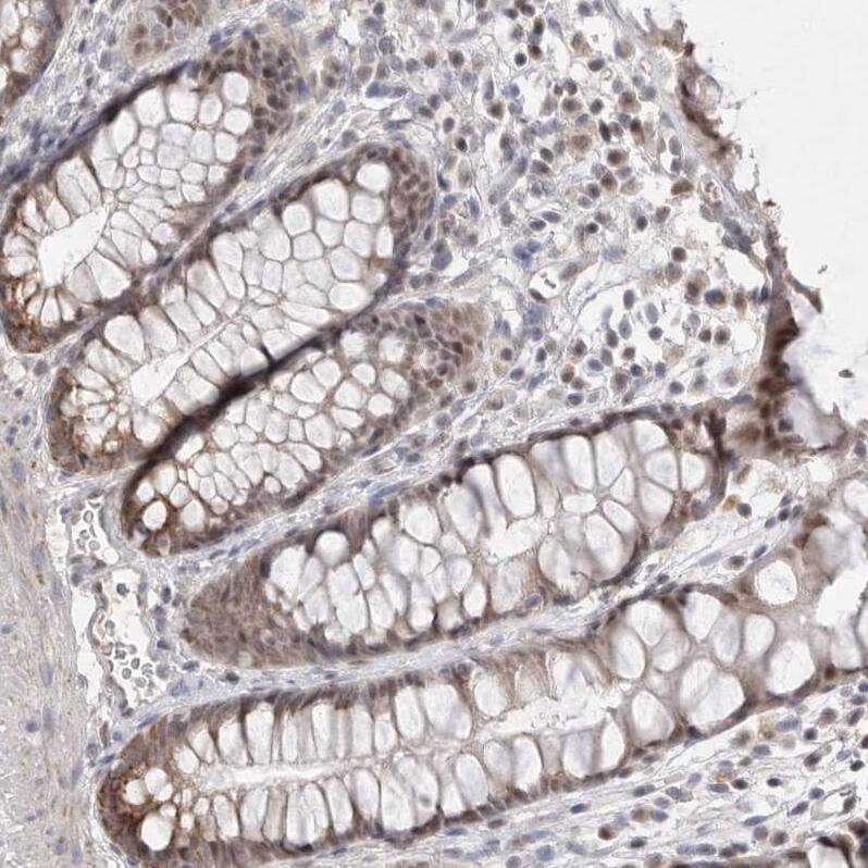 HUS1 Antibody - BSA Free Immunohistochemistry-Paraffin: HUS1 Antibody - BSA Free [NBP1-89445]