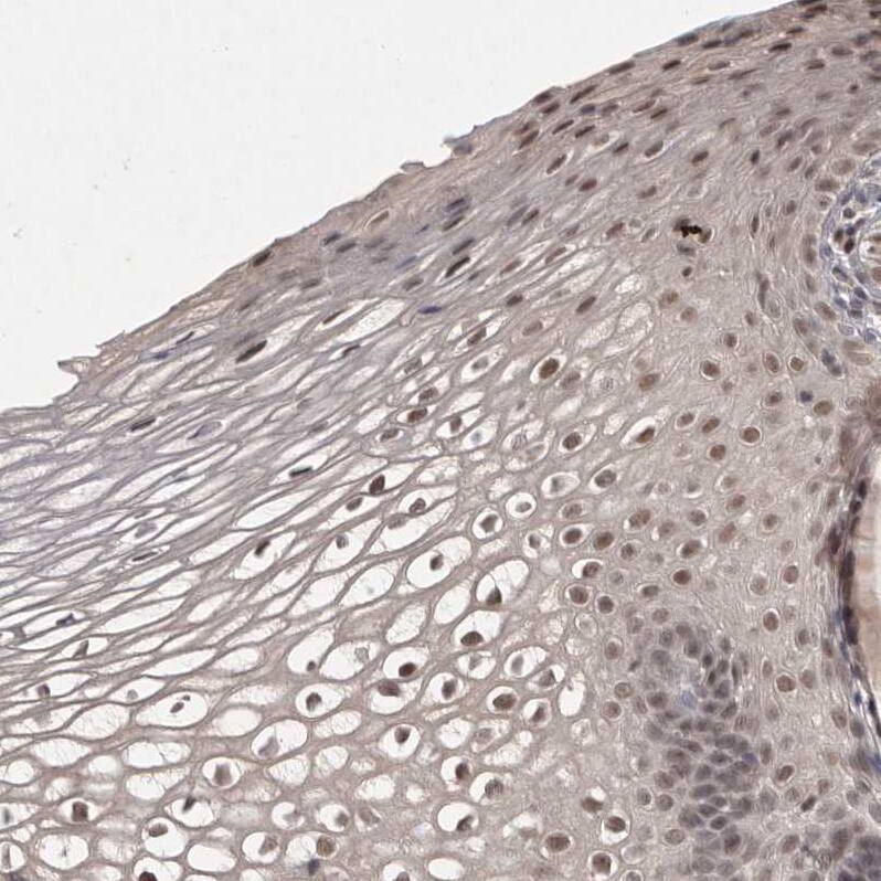 HUS1 Antibody - BSA Free Immunohistochemistry-Paraffin: HUS1 Antibody - BSA Free [NBP1-89445]