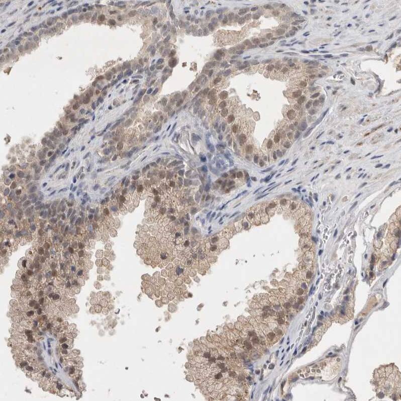 HUS1 Antibody - BSA Free Immunohistochemistry-Paraffin: HUS1 Antibody - BSA Free [NBP1-89445]