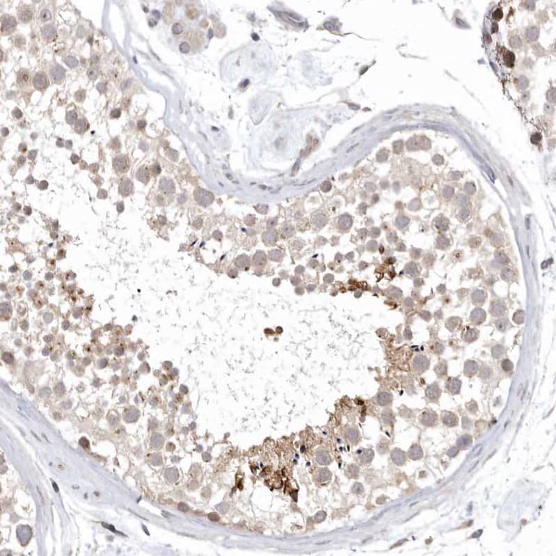 KIF2B Antibody - BSA Free Immunohistochemistry-Paraffin: KIF2B Antibody - BSA Free [NBP1-89446]