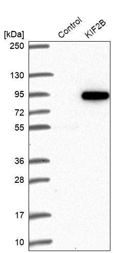 KIF2B Antibody - BSA Free Western Blot: KIF2B Antibody - BSA Free [NBP1-89446]