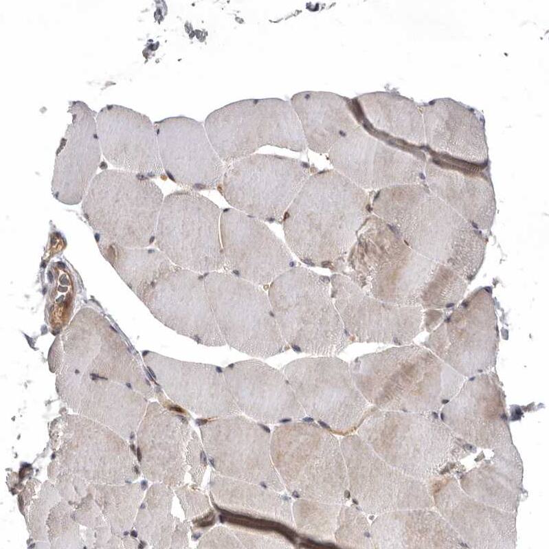 KIF2B Antibody - BSA Free Immunohistochemistry-Paraffin: KIF2B Antibody - BSA Free [NBP1-89446]