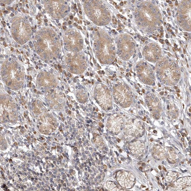 KIF2B Antibody - BSA Free Immunohistochemistry-Paraffin: KIF2B Antibody - BSA Free [NBP1-89446]