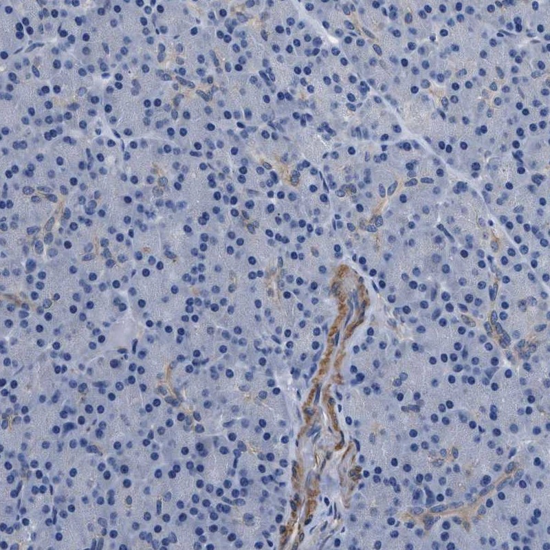 PARG Antibody - BSA Free Immunohistochemistry-Paraffin: PARG Antibody - BSA Free [NBP1-89450]
