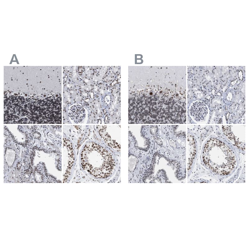 TPR Antibody - BSA Free Immunohistochemistry-Paraffin: TPR Antibody - BSA Free [NBP1-89452]
