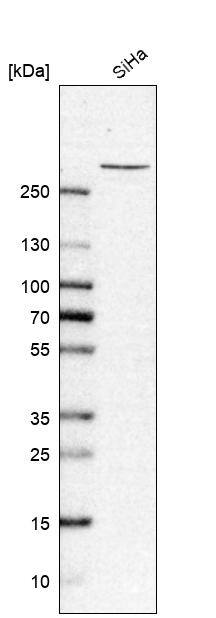 TPR Antibody - BSA Free Western Blot: TPR Antibody - BSA Free [NBP1-89452]