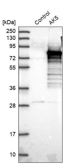 AK5 Antibody - BSA Free Western Blot: AK5 Antibody - BSA Free [NBP1-89453]