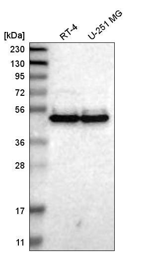 TWISTNB Antibody - BSA Free Western Blot: TWISTNB Antibody - BSA Free [NBP1-89454]