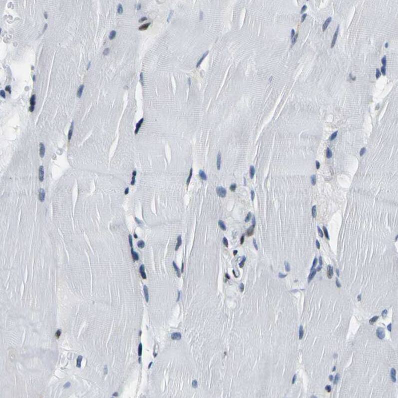 SP1 Antibody - BSA Free Immunohistochemistry-Paraffin: SP1 Antibody [NBP1-89458]