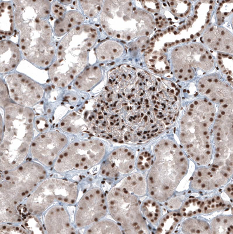 SP1 Antibody - BSA Free Immunohistochemistry-Paraffin: SP1 Antibody [NBP1-89458]
