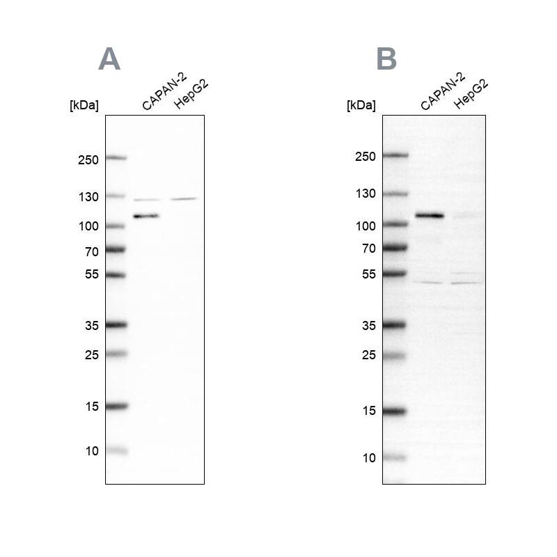 SP1 Antibody - BSA Free Western Blot: SP1 Antibody - BSA Free [NBP1-89458]