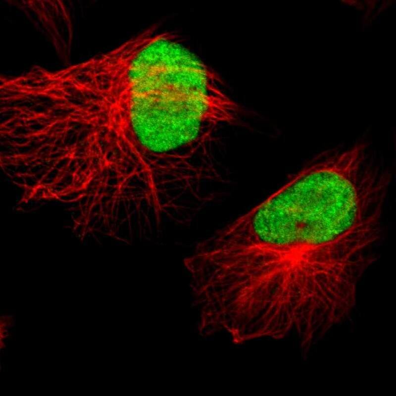 XRCC4 Antibody - BSA Free Immunocytochemistry/ Immunofluorescence: XRCC4 Antibody [NBP1-89463]