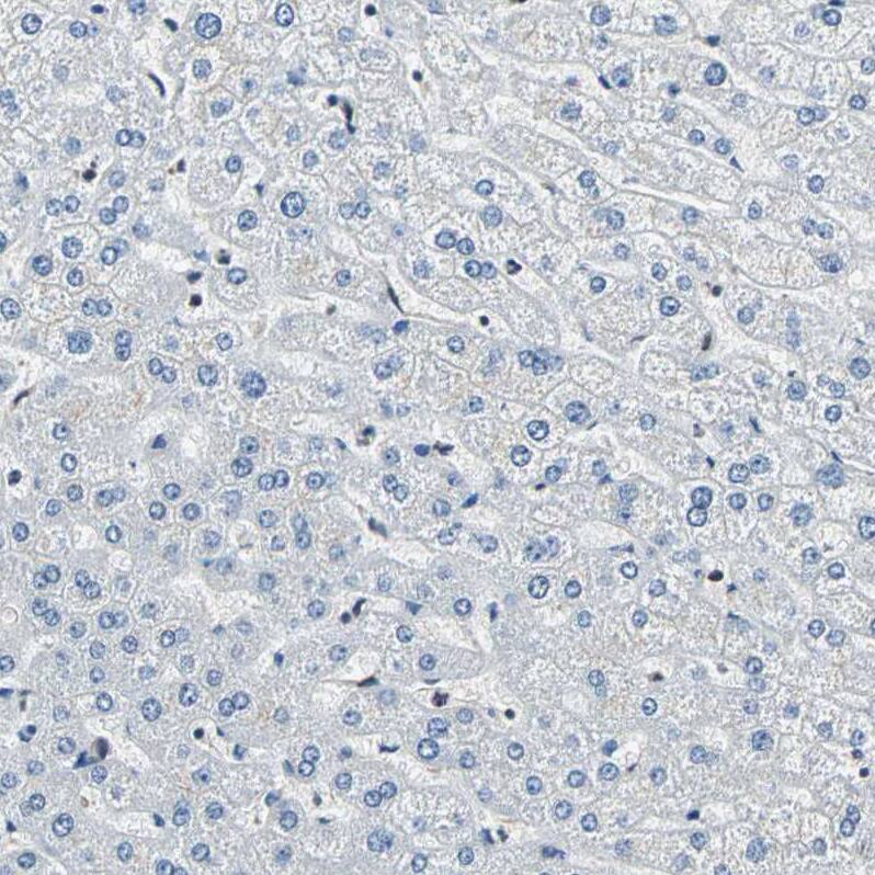 XRCC4 Antibody - BSA Free Immunohistochemistry-Paraffin: XRCC4 Antibody - BSA Free [NBP1-89463]
