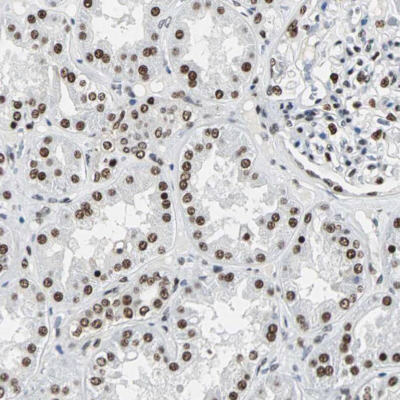 XRCC4 Antibody - BSA Free Immunohistochemistry-Paraffin: XRCC4 Antibody - BSA Free [NBP1-89463]