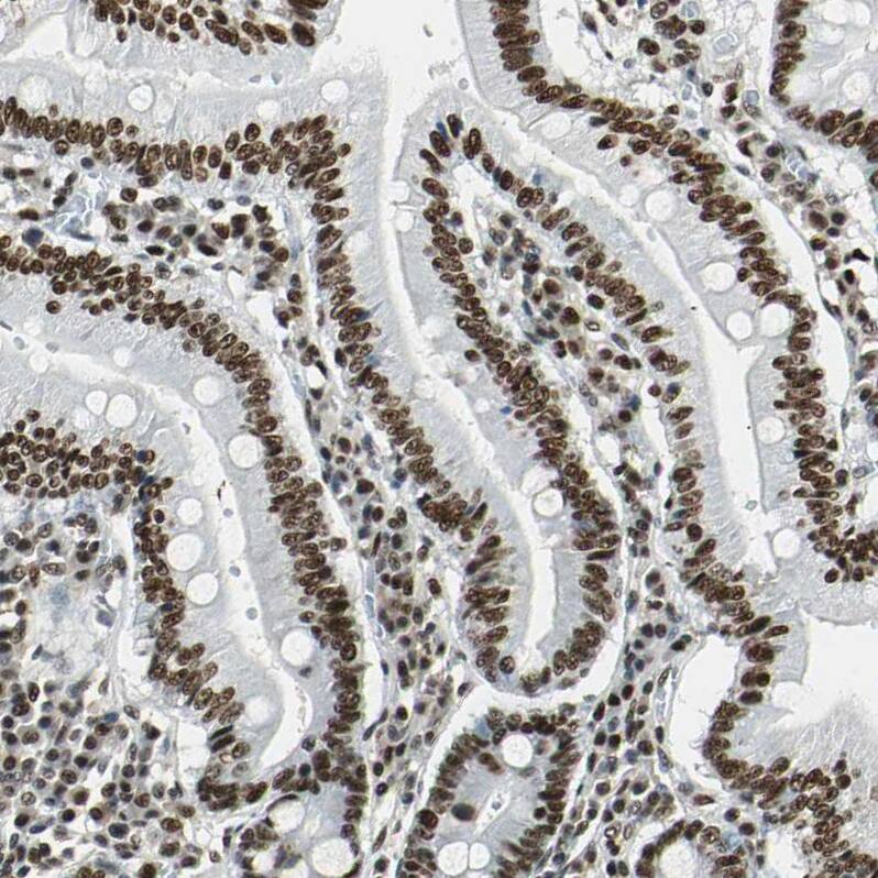 XRCC4 Antibody - BSA Free Immunohistochemistry-Paraffin: XRCC4 Antibody - BSA Free [NBP1-89463]