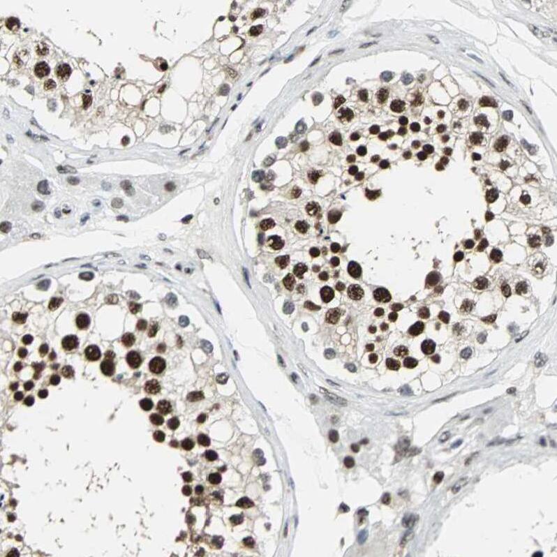 XRCC4 Antibody - BSA Free Immunohistochemistry-Paraffin: XRCC4 Antibody - BSA Free [NBP1-89463]