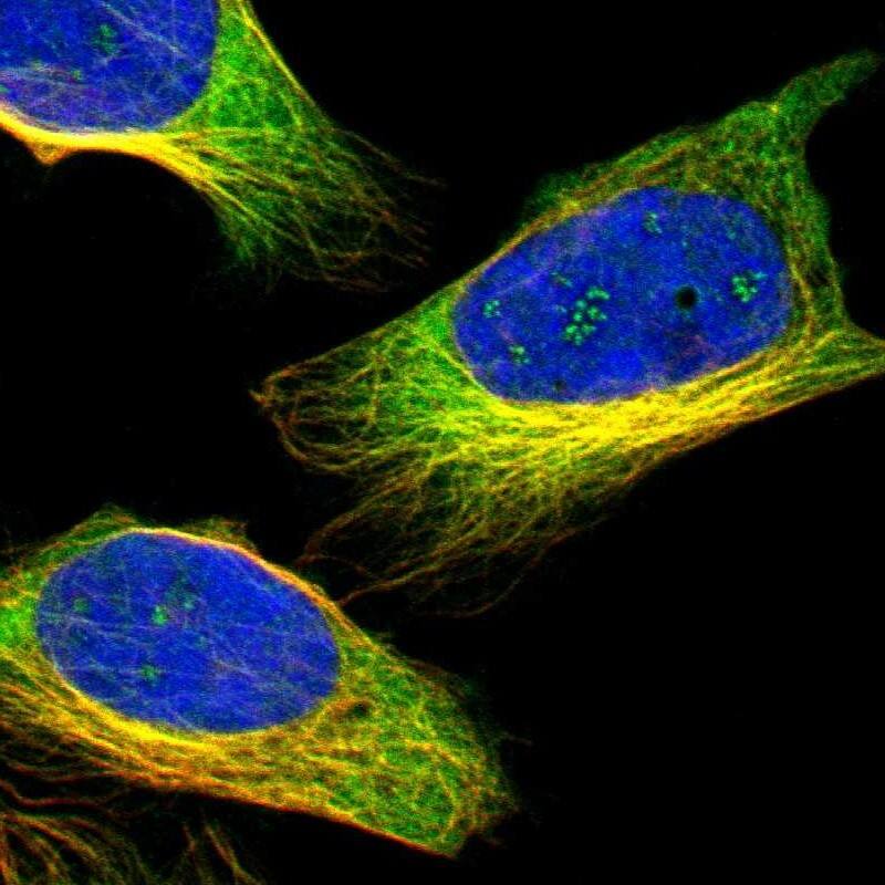 ZNF415 Antibody - BSA Free Immunocytochemistry/ Immunofluorescence: ZNF415 Antibody [NBP1-89466]