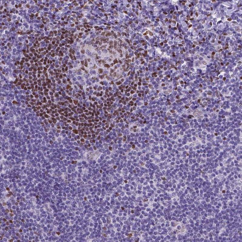 MEF2C Antibody - BSA Free Immunohistochemistry-Paraffin: MEF2C Antibody - BSA Free [NBP1-89468]