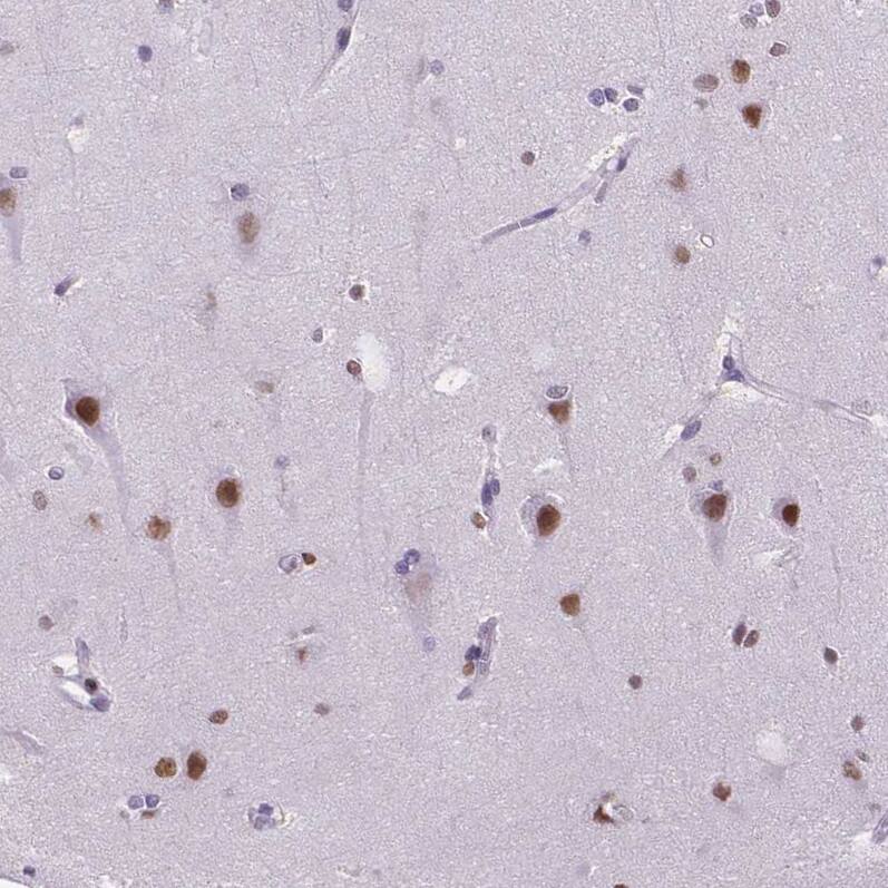 MEF2C Antibody - BSA Free Immunohistochemistry-Paraffin: MEF2C Antibody - BSA Free [NBP1-89468]