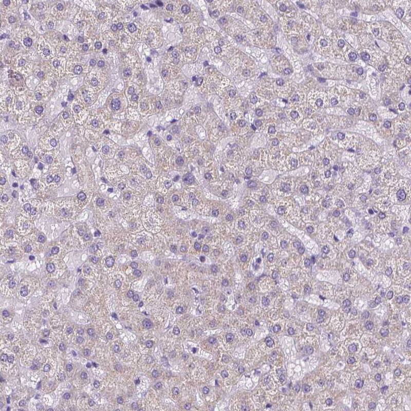 MEF2C Antibody - BSA Free Immunohistochemistry-Paraffin: MEF2C Antibody - BSA Free [NBP1-89468]