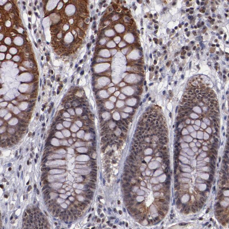 DDX24 Antibody - BSA Free Immunohistochemistry-Paraffin: DDX24 Antibody - BSA Free [NBP1-89472]