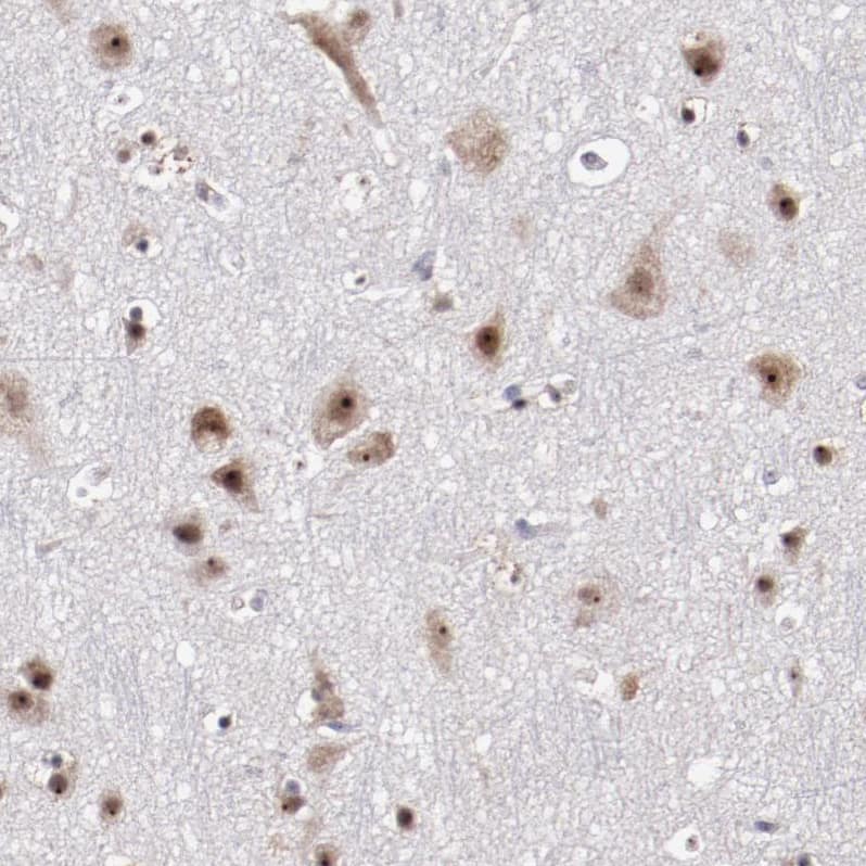 DDX24 Antibody - BSA Free Immunohistochemistry-Paraffin: DDX24 Antibody - BSA Free [NBP1-89472]