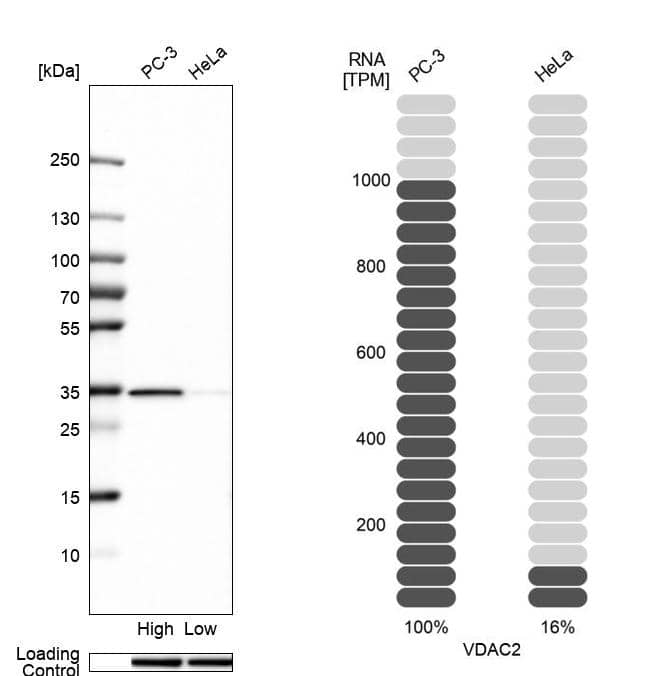 VDAC2 Antibody - BSA Free Western Blot: VDAC2 Antibody - BSA Free [NBP1-89477]