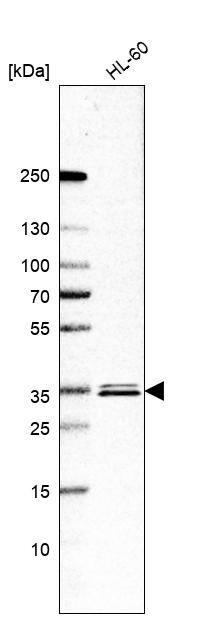 ESD Antibody - BSA Free Western Blot: ESD Antibody - BSA Free [NBP1-89479]