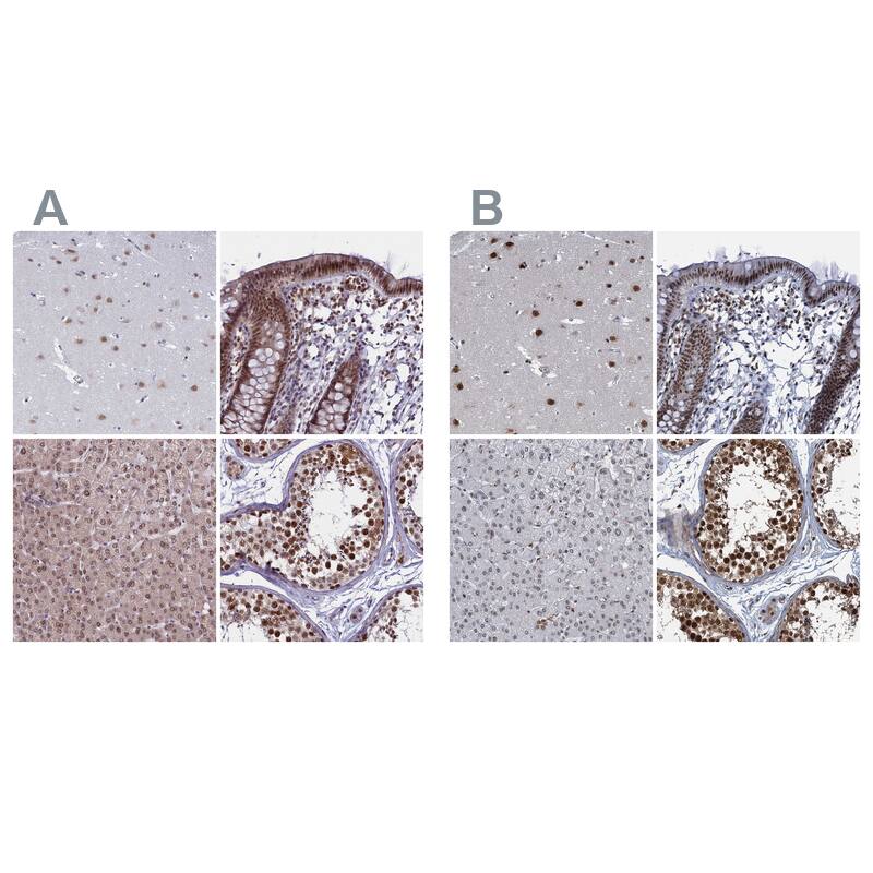PPHLN1 Antibody - BSA Free Immunohistochemistry-Paraffin: PPHLN1 Antibody - BSA Free [NBP1-89480]