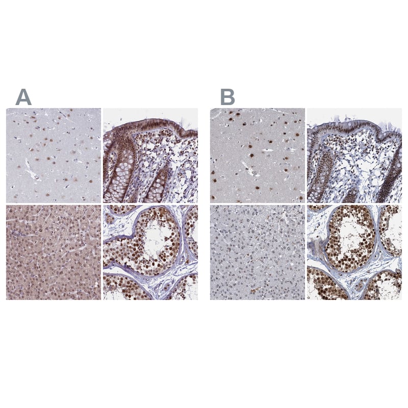 PPHLN1 Antibody - BSA Free Immunohistochemistry-Paraffin: PPHLN1 Antibody - BSA Free [NBP1-89480]
