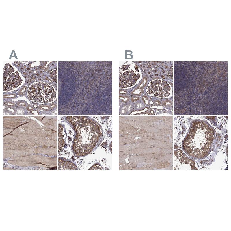MAP4 Antibody - BSA Free Immunohistochemistry-Paraffin: MAP4 Antibody - BSA Free [NBP1-89483]