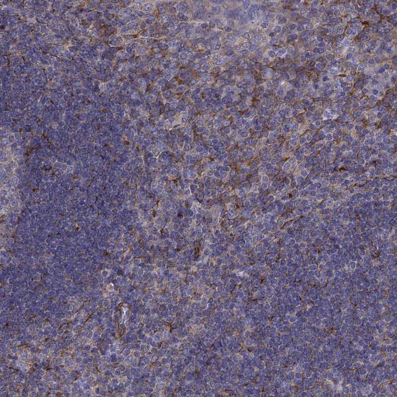 MAP4 Antibody - BSA Free Immunohistochemistry-Paraffin: MAP4 Antibody - BSA Free [NBP1-89483]