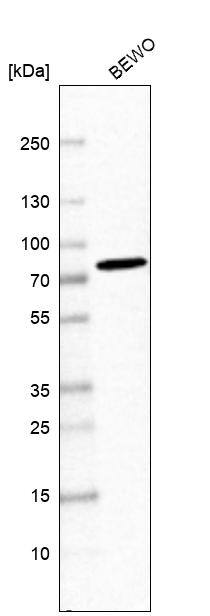 SNX2 Antibody - BSA Free Western Blot: SNX2 Antibody - BSA Free [NBP1-89485]