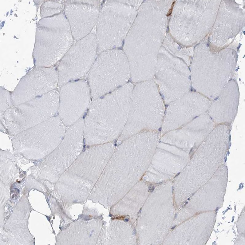 SNX2 Antibody - BSA Free Immunohistochemistry-Paraffin: SNX2 Antibody - BSA Free [NBP1-89485]