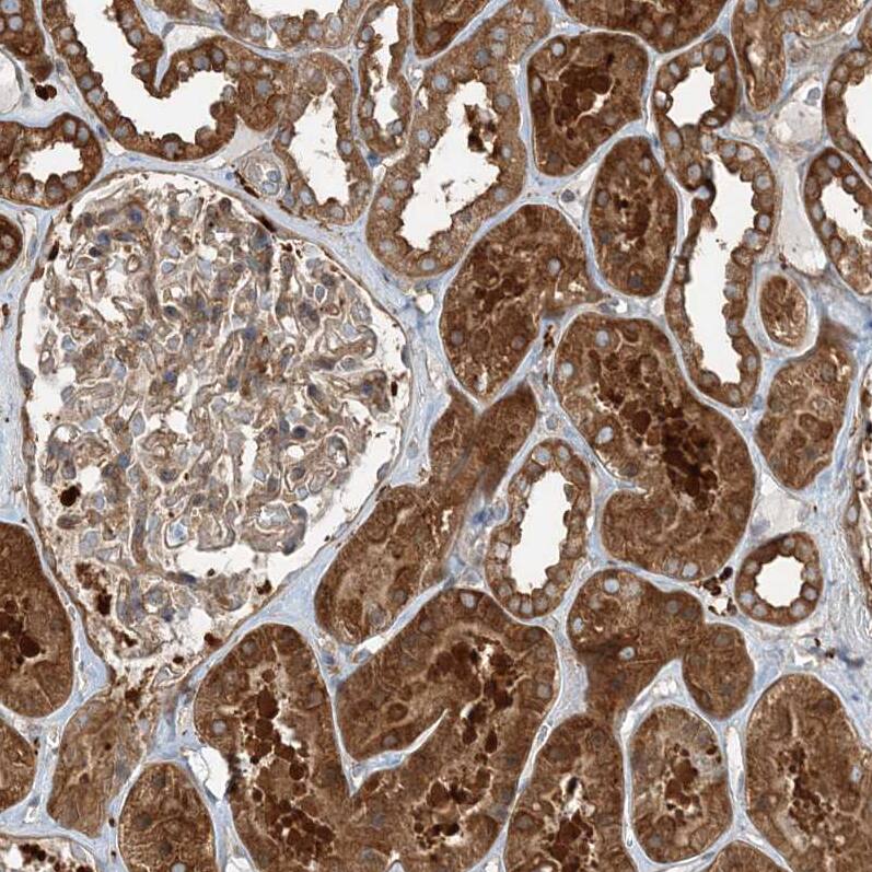 SNX2 Antibody - BSA Free Immunohistochemistry-Paraffin: SNX2 Antibody - BSA Free [NBP1-89485]
