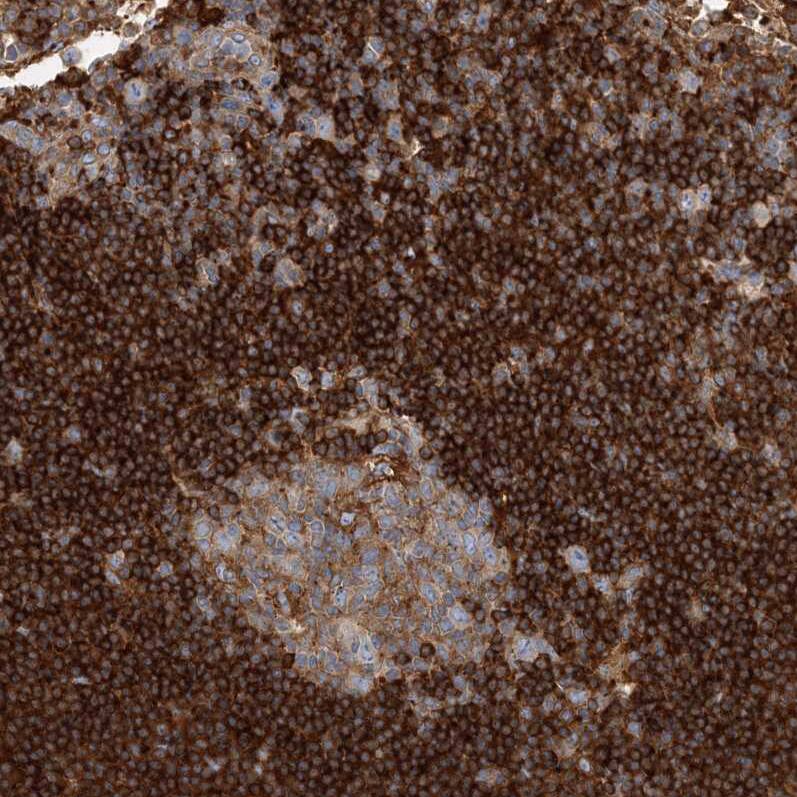 SNX2 Antibody - BSA Free Immunohistochemistry-Paraffin: SNX2 Antibody - BSA Free [NBP1-89485]