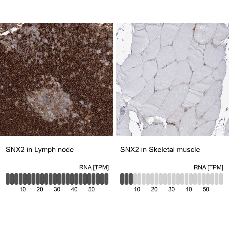 SNX2 Antibody - BSA Free Immunohistochemistry-Paraffin: SNX2 Antibody - BSA Free [NBP1-89485]