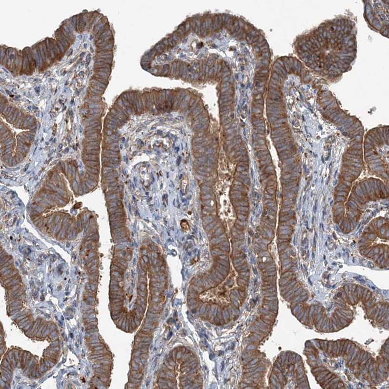 SNX2 Antibody - BSA Free Immunohistochemistry-Paraffin: SNX2 Antibody - BSA Free [NBP1-89485]