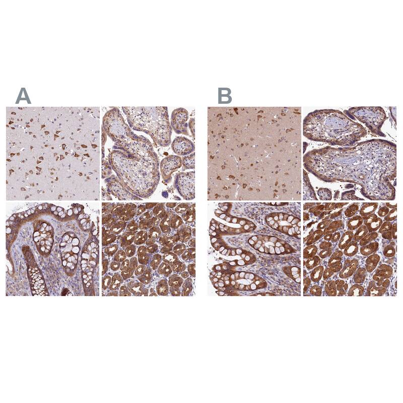 QARS Antibody - BSA Free Immunohistochemistry-Paraffin: QARS Antibody - BSA Free [NBP1-89487]