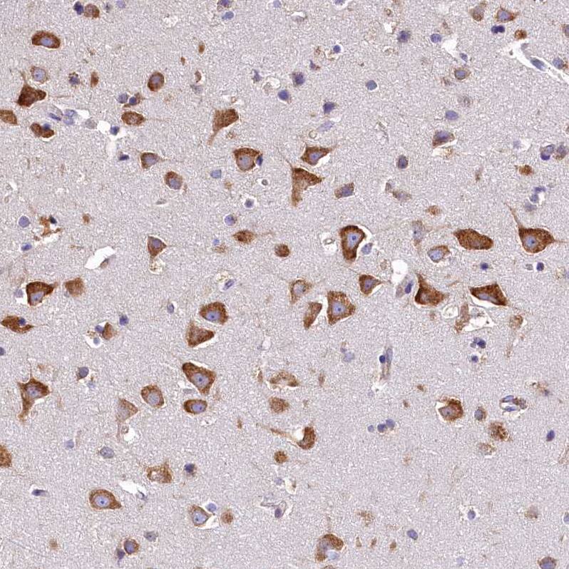 QARS Antibody - BSA Free Immunohistochemistry-Paraffin: QARS Antibody - BSA Free [NBP1-89487]